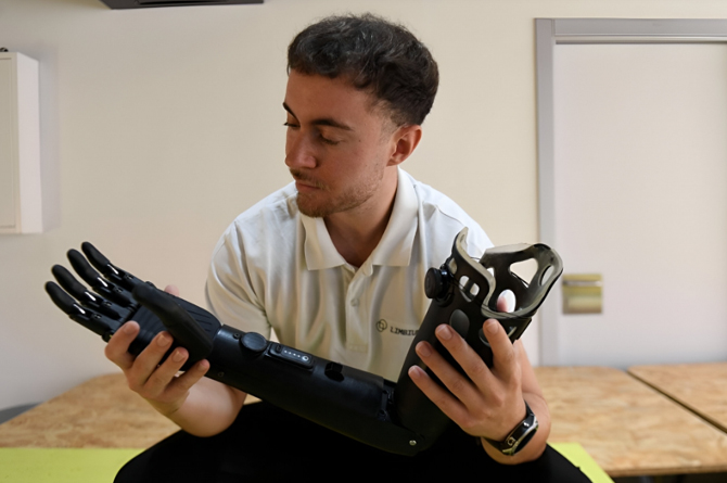 Alberto Mart&iacute;nez con uno de los brazos bi&oacute;nicos